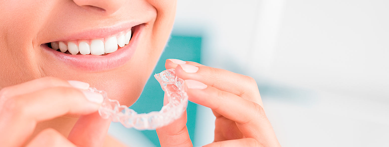 Invisalign Basel